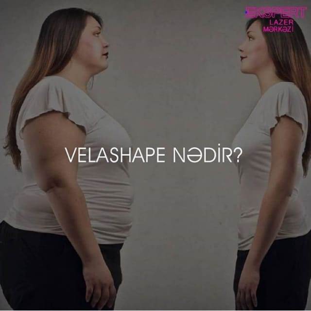 VelaShape nədir ?